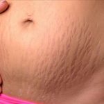 Najbolji prirodni tretmani za uklanjanje celulita, hidrataciju kože i mršavljenje