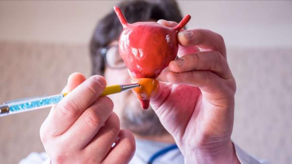 Najbolji tretmani za adenom prostate - Lijekovi, kirurgija i prirodne metode